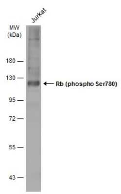 Western Blot: RB1 [p Ser780] Antibody [NBP3-13308] - Whole cell extract (30 ug) was separated by 7.5% SDS-PAGE, and the membrane was blotted with RB1 (phospho Ser780) antibody (NBP3-13308) diluted at 1:500. The HRP-conjugated anti-rabbit IgG antibody (NBP2-19301) was used to detect the primary antibody.